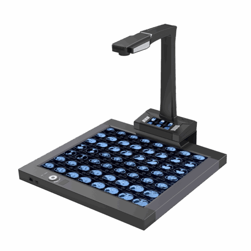CT160 Featured Image